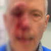 An elderly pro-life activist was assaulted outside a Baltimore, Maryland Planned Parenthood clinic, according to the leader of a local pro-life group.Photo courtesy of Baltimore County Right to Life.