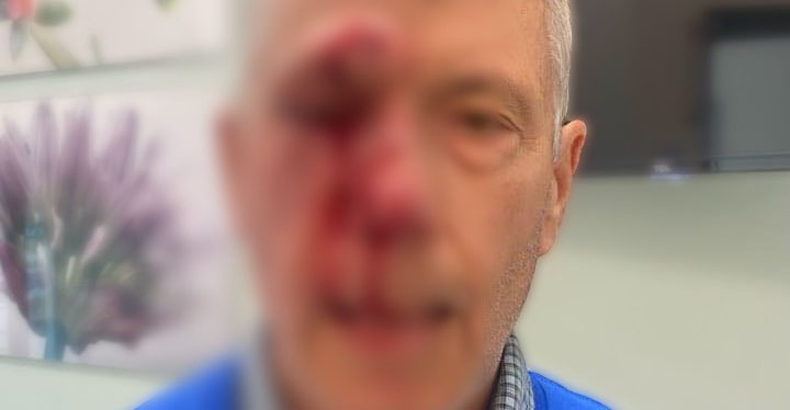 Baltimore Police Seek Assailant in Beating of 2 Elderly Pro-Life Activists Outside Abortion Clinic