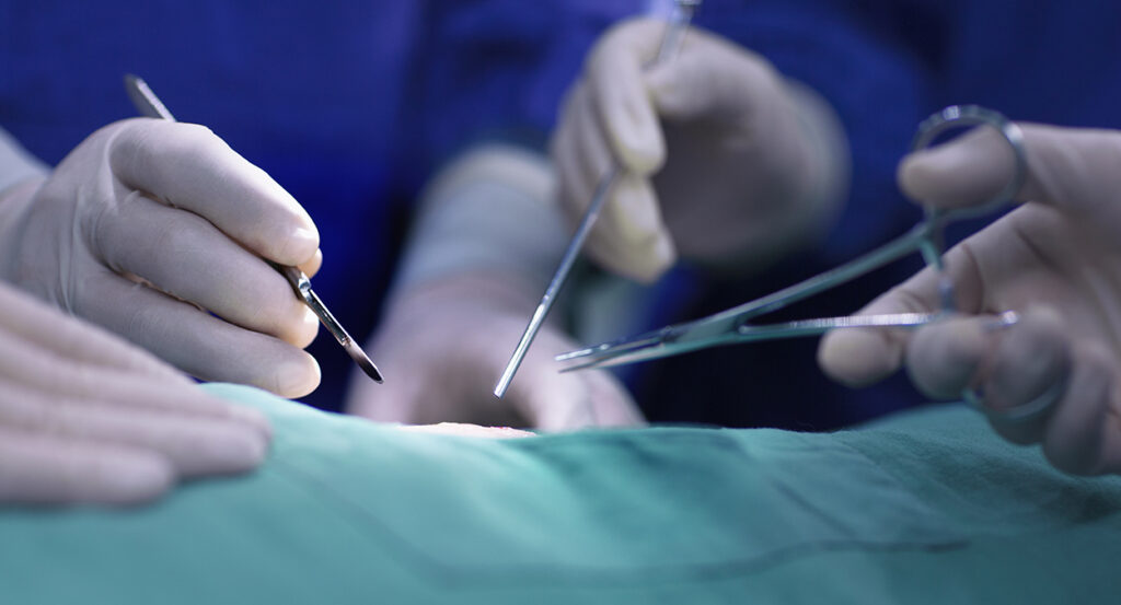 Doctors' hands hold surgical implements above skin