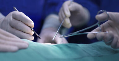 Doctors' hands hold surgical implements above skin