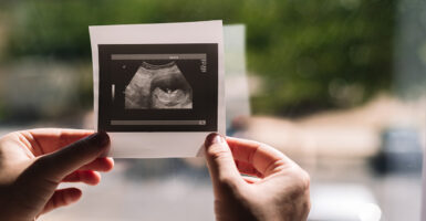 A woman holds an ultrasound photo of a baby.