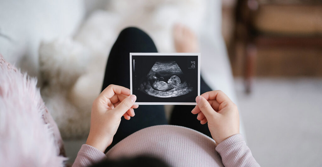 A pregnant woman holds an ultrasound picture of her baby.